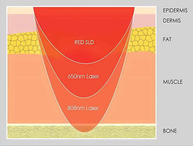 QQ20241122170813 QQ20241122170813