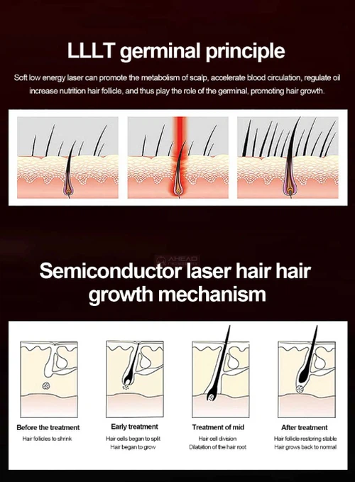 red restore laser cap1 red restore laser cap1