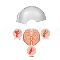 Terapi Cahaya Merah untuk Alzheimer